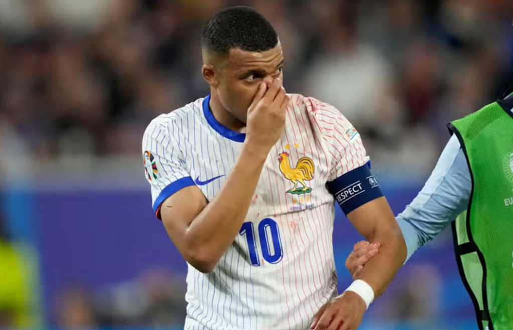 France narrowly beat Austria in the first game of Euro 2024, with Mbappe sustaining a fractured nose.